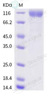 SARS-CoV-2 Spike Protein S1 (D614G) His-tag Protein