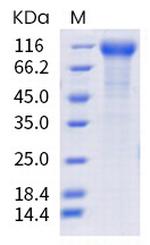 SARS-CoV-2 Spike Protein S1 (mutant) His-tag Protein