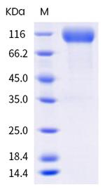 SARS-CoV-2 Spike Protein S1 (mutant) His-tag Protein