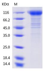 SARS-CoV-2 Spike Protein S1 (N234Q) His-tag Protein