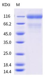 SARS-CoV-2 Spike Protein S1 (mutant) His-tag Protein