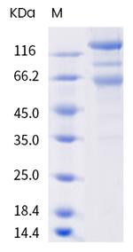 SARS-CoV-2 Spike Protein S1/S2 (B.1.351) His-tag Protein