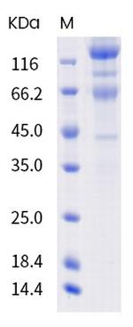 SARS-CoV-2 Spike Protein S1/S2 (B.1.351) His-tag Protein