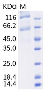 SARS-CoV-2 Spike Protein S1/S2 (P.1) His-tag Protein