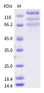 SARS-CoV-2 Spike Protein S1/S2 (D614G) His-tag Protein