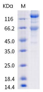SARS-CoV-2 Spike Protein S1/S2 (mutant) His-tag Protein