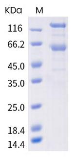 SARS-CoV-2 Spike Protein S1/S2 (mutant) His-tag Protein