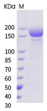 SARS-CoV-2 Spike Protein S1/S2 (mutant) His-tag Protein