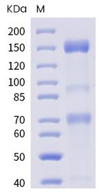 SARS-CoV-2 Spike Protein S1/S2 His-tag Protein