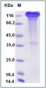 SARS-CoV-2 Spike Protein S1 Fc Chimera Protein