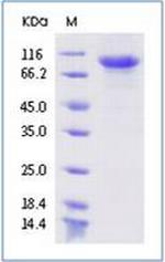 SARS-CoV-2 Spike Protein S1 His-tag Protein