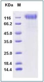 SARS-CoV-2 Spike Protein S1 His-tag (HPLC verified) Protein