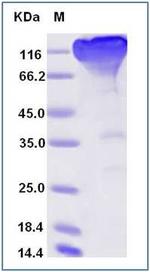 SARS-CoV-2 Spike Protein S1 Fc Chimera Protein