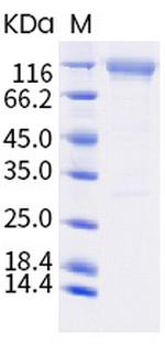 SARS-CoV-2 Spike Protein S2 (E780Q) Fc Chimera Protein