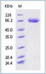 SARS-CoV-2 Spike Protein S2 His-tag Protein