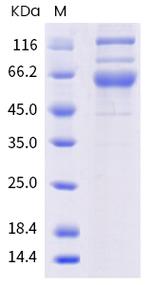 SARS-CoV-2 Spike Protein S1/S2 (AY.4.2) His-tag Protein