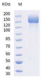 SARS-CoV-2 Spike Protein S1/S2 (B.1.617.1) His-tag, trimer Protein