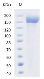 SARS-CoV-2 Spike Protein S1/S2 (B.1.617.2) His-tag, trimer Protein