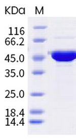 SARS-CoV-2 Nucleocapsid (A12G, T205I) His-tag Protein
