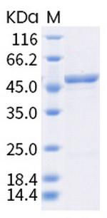 SARS-CoV-2 Nucleocapsid (A220V) His-tag Protein