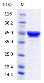 SARS-CoV-2 Nucleocapsid (B.1.617.2) His-tag Protein