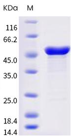 SARS-CoV-2 Nucleocapsid (AY.1; AY.3) His-tag Protein