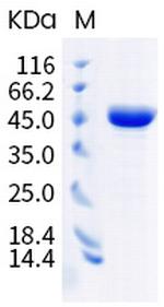 SARS-CoV-2 Nucleocapsid (M234L) His-tag Protein