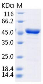 SARS-CoV-2 Nucleocapsid (P199L) His-tag Protein