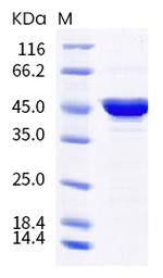 SARS-CoV-2 Nucleocapsid (B.1.526) His-tag Protein