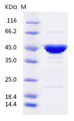 SARS-CoV-2 Nucleocapsid (P67S) His-tag Protein