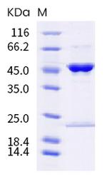 SARS-CoV-2 Nucleocapsid (P67S, P199L) His-tag Protein