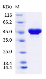SARS-CoV-2 Nucleocapsid (B.1.617.3) His-tag Protein