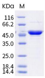SARS-CoV-2 Nucleocapsid (B.1.617; B.1.617.1) His-tag Protein