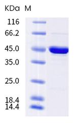 SARS-CoV-2 Nucleocapsid (S202N) His-tag Protein