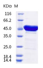 SARS-CoV-2 Nucleocapsid His-tag (HPLC-verified) Protein