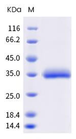SARS-CoV-2 Spike Protein (RBD) (E471A) His-tag Protein