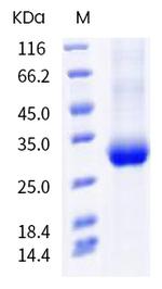 SARS-CoV-2 Spike Protein (RBD) (E471D) His-tag Protein