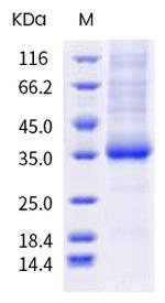 SARS-CoV-2 Spike Protein (RBD) (E484A) His-tag Protein