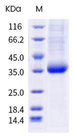 SARS-CoV-2 Spike Protein (RBD) (E484D) His-tag Protein