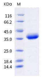 SARS-CoV-2 Spike Protein (RBD) (mutant) His-Avi Tag Protein
