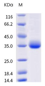 SARS-CoV-2 Spike Protein (RBD) (P.3) His-tag Protein