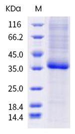 SARS-CoV-2 Spike Protein (RBD) (G476A) His-tag Protein