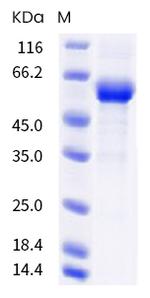 SARS-CoV-2 Spike Protein (RBD) (B.1.351) Fc Chimera Protein