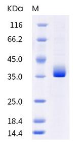 SARS-CoV-2 Spike Protein (RBD) (B.1.351) His-Avi Tag Protein