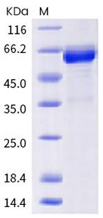 SARS-CoV-2 Spike Protein (RBD) (C.37) Fc Chimera Protein