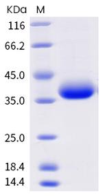 SARS-CoV-2 Spike Protein (RBD) (C.37) His-Avi Tag Protein