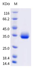 SARS-CoV-2 Spike Protein (RBD) (C.37) His-tag Protein