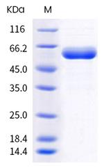 SARS-CoV-2 Spike Protein (RBD) (B.1.617) Fc Chimera Protein