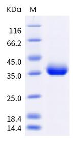 SARS-CoV-2 Spike Protein (RBD) (B.1.617) His-Avi Tag Protein