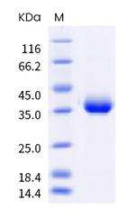 SARS-CoV-2 Spike Protein (RBD) (B.1.617.2) His-Avi Tag Protein